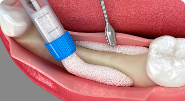 Treatment Image