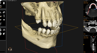 Treatment Image