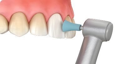 Treatment Image